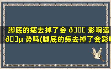 脚底的痣去掉了会 🕊 影响运 🐵 势吗(脚底的痣去掉了会影响运势吗女生)